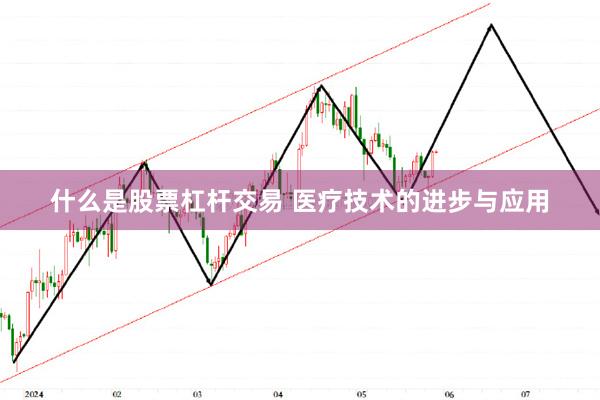 什么是股票杠杆交易 医疗技术的进步与应用